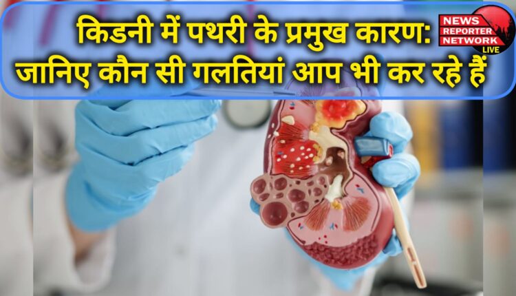 Major causes of kidney stones Know which mistakes you are also making