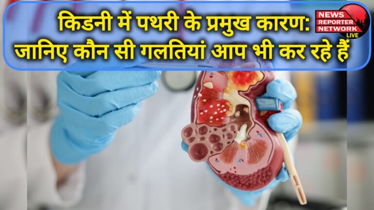 Major causes of kidney stones Know which mistakes you are also making