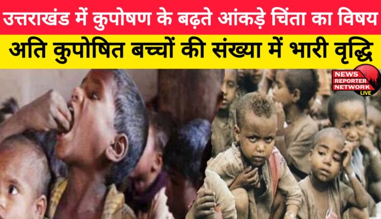 Rising figures of malnutrition in Uttarakhand are a matter of concern, huge increase in the number of severely malnourished children
