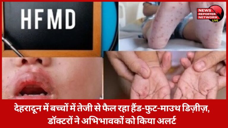 Hand-Foot-Mouth Disease is spreading rapidly among children in Dehradun, doctors have alerted parents.
