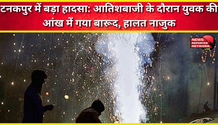 Major accident in Tanakpur Gunpowder got into the eyes of a youth during fireworks, his condition is critical.