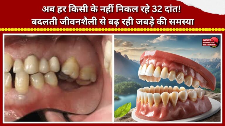 Not everyone is developing a full set of 32 teeth anymore! Jaw problems are on the rise due to changing lifestyles.